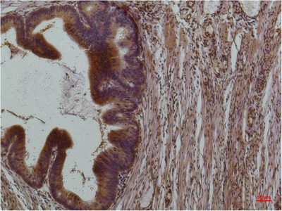 STAT3 (PTR1364) Mouse mAb