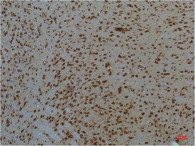 STAT3 (PTR1364) Mouse mAb