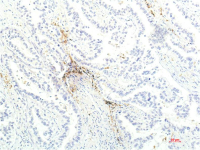 JAK1 (7G6) Mouse mAb