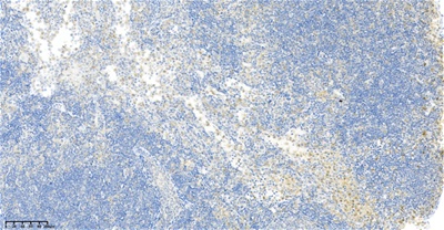 p38 (PT0436R) PT® Rabbit mAb