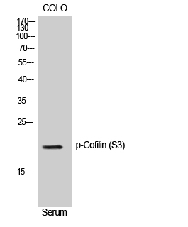 Cofilin (Phospho Ser3) Rabbit pAb