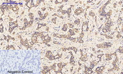 JAK1 (phospho Tyr1034) Polyclonal Antibody