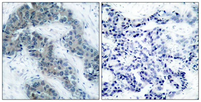 JAK2 (Phospho Tyr1007) Rabbit pAb