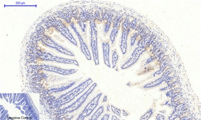 JAK2 (Phospho Tyr1007) Rabbit pAb