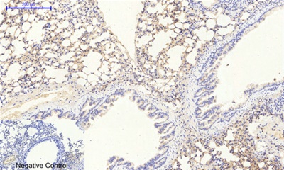 JAK2 (Phospho Tyr1007) Rabbit pAb