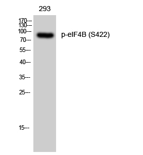 eIF4B (Phospho Ser422) Rabbit pAb