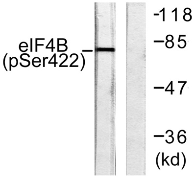 eIF4B (Phospho Ser422) Rabbit pAb