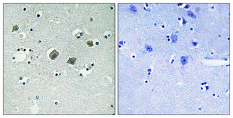 JAK2 (Phospho Tyr570) Rabbit pAb