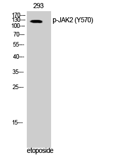 JAK2 (Phospho Tyr570) Rabbit pAb