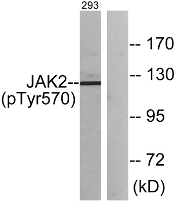 JAK2 (Phospho Tyr570) Rabbit pAb