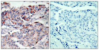 JAK2 (Phospho Tyr221) Rabbit pAb