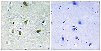 JAK2 (Phospho Tyr931) Rabbit pAb