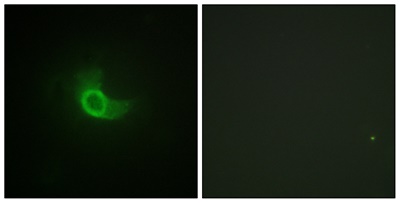 CD130 Rabbit pAb
