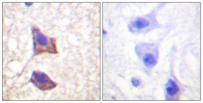 CD130 Rabbit pAb