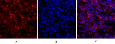 JAK1 (PT0658R) PT® Rabbit mAb