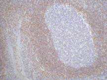 Bcl-2 Monoclonal Antibody(6B5)