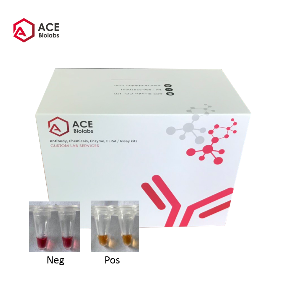 Environmental COVID-19 (SARS-CoV-2) RBD Nucleic Acid Rapid Detection Kit (Isothermal Amplification Method)