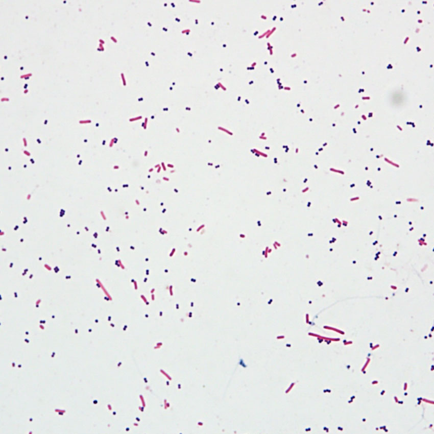 Gram Staining Kit