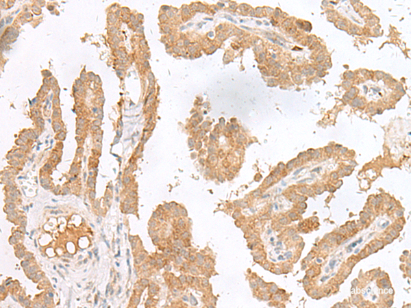 Human CXCL6 Antibody