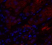 Human IL-8 Polyclonal Antibody
