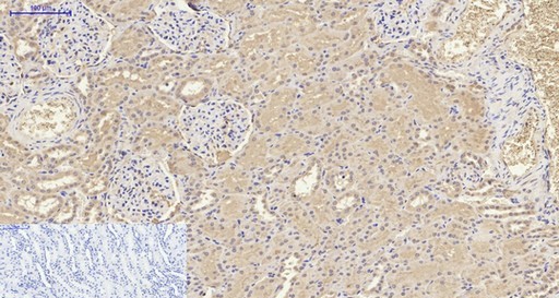 Human IL-8 Polyclonal Antibody