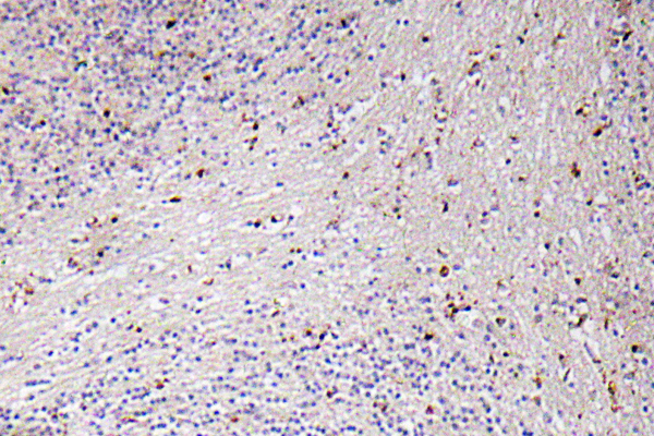 Human CXCL1/CROa antibody