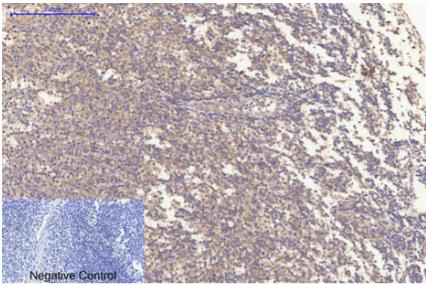 Bax mouse Monoclonal Antibody(6F11)