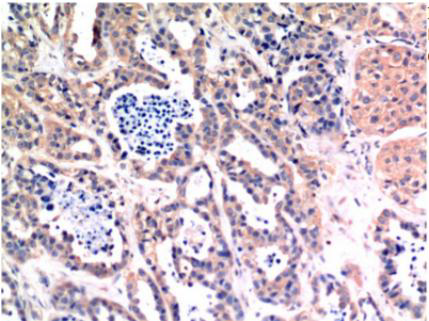 Bax mouse Monoclonal Antibody(6F11)