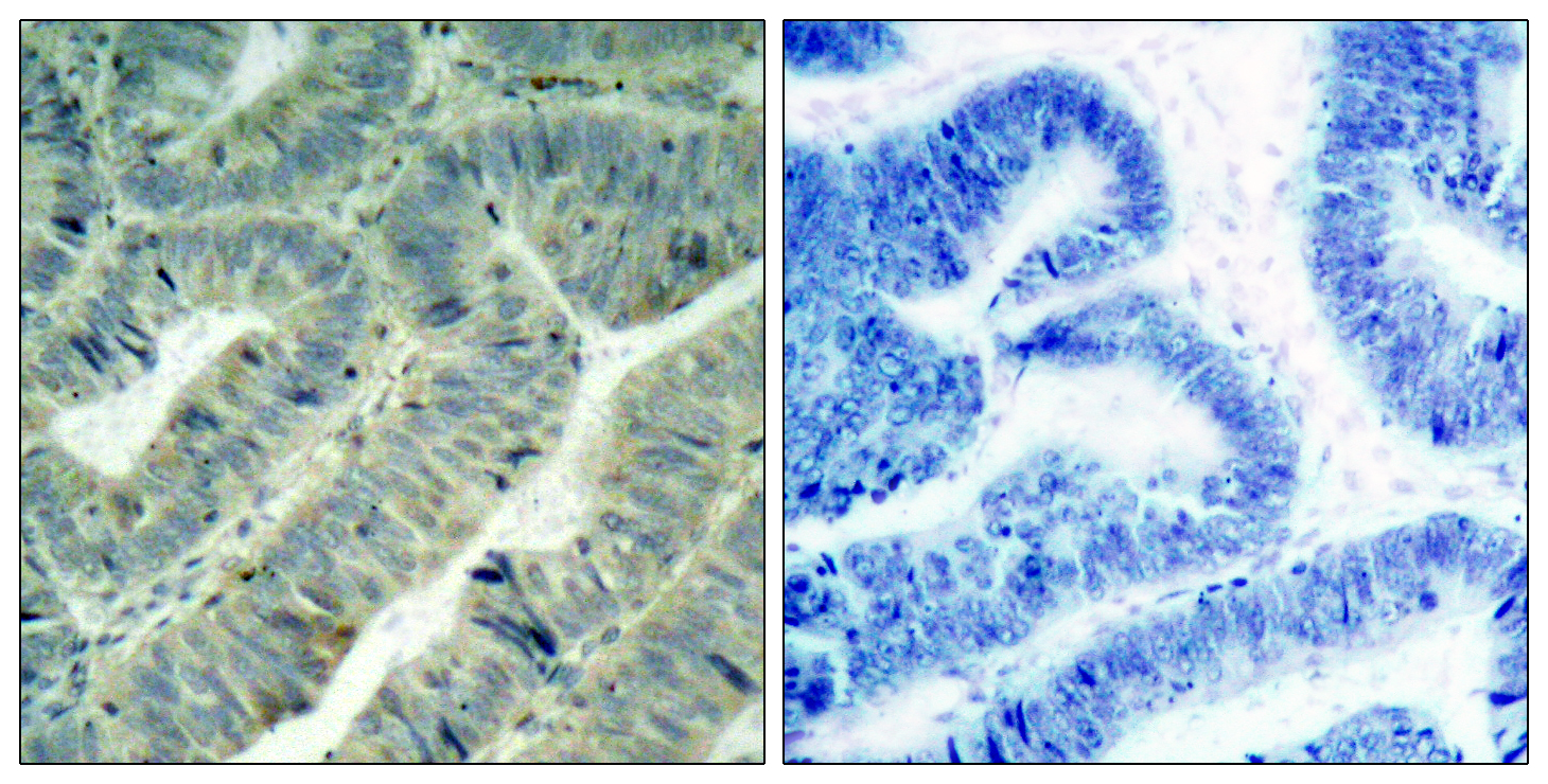 Phospho-c-SRC (Tyr419) Polyclonal Antibody