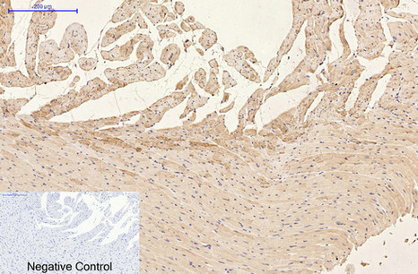 GFAP Monoclonal Antibody(5C8)