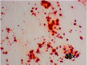 Mesenchymal Stem Cell Osteogenic Differentiation Kit