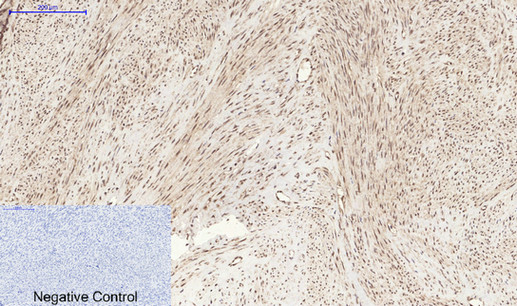 Stat3 (Phospho Ser727) Rabbit pAb
