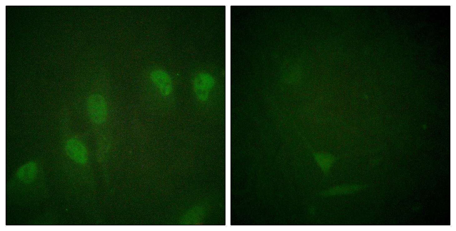 c-Myc (Phospho Ser62) Rabbit pAb
