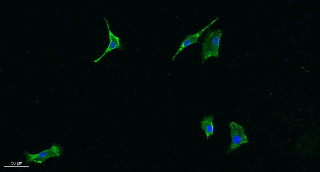 JAK1 (PT0658R) PT® Rabbit mAb
