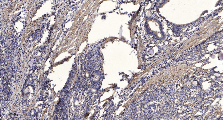 Jak1(Phospho Tyr1034/1035) Rabbit pAb