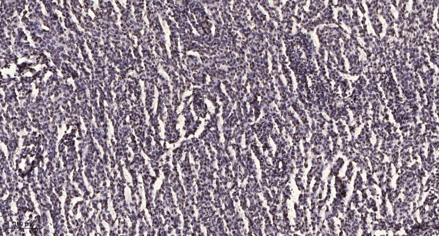 Stat3 (Acetyl Lys49) Rabbit pAb