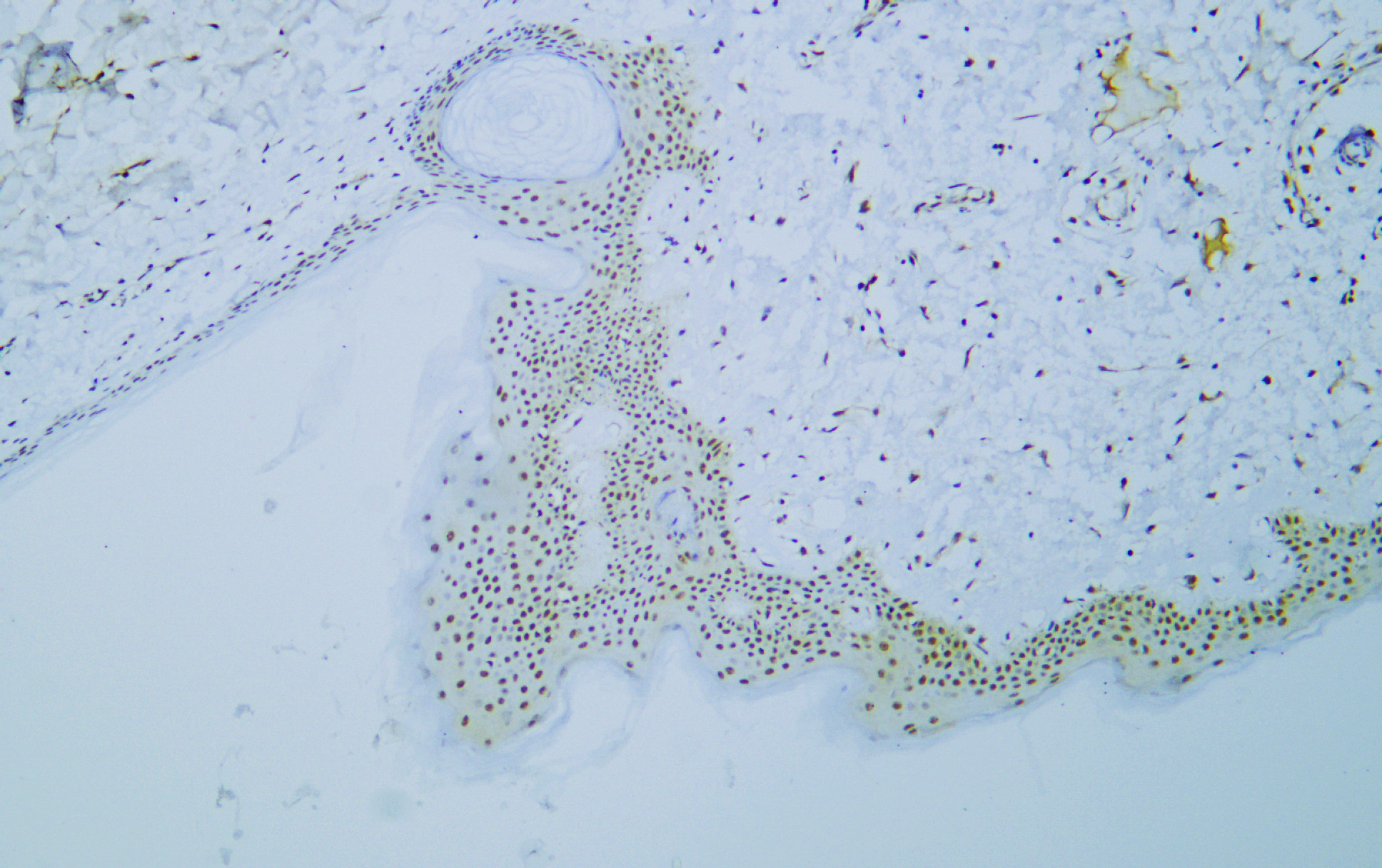 c-MYC (PTR2340) Mouse mAb