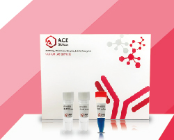 ACE Scipt II One Step RT-PCR Kit (Dye Plus)