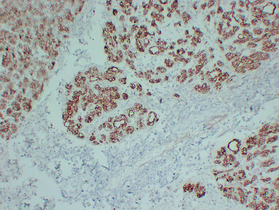 Claudin 4 (PT1925) mouse mAb