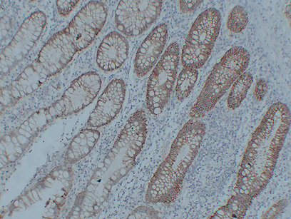 Claudin 3 (PT1687) mouse mAb