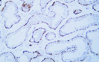 MAGE-C1(ABT-MAGEC1) mouse mAb