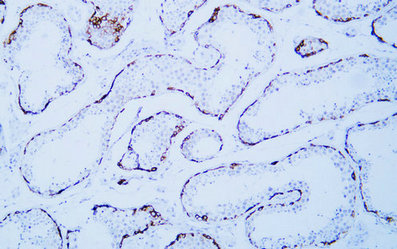 MAGE-C1(ABT-MAGEC1) mouse mAb