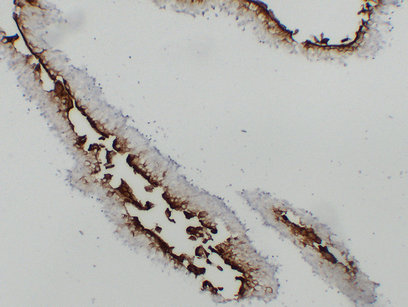 Uroplakin III (ABT-UPK3) mouse mAb