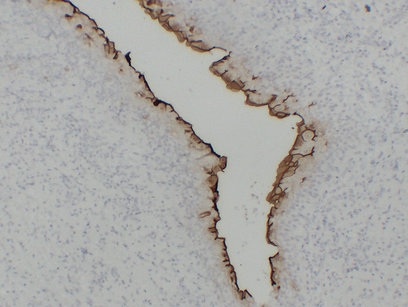 Uroplakin III (ABT-UPK3) mouse mAb