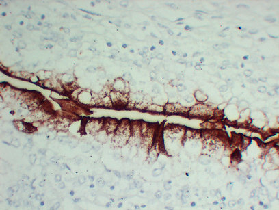 Uroplakin III (ABT-UPK3) mouse mAb