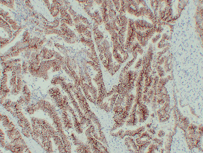 Claudin 7 (PT0731) mouse mAb