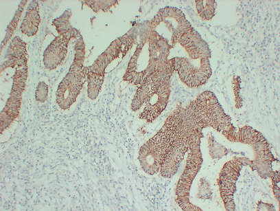 Claudin 7 (PT0731) mouse mAb