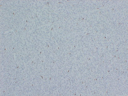 Factor XIIIa (PT1976) mouse mAb