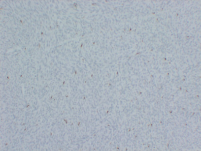 Factor XIIIa (PT1976) mouse mAb