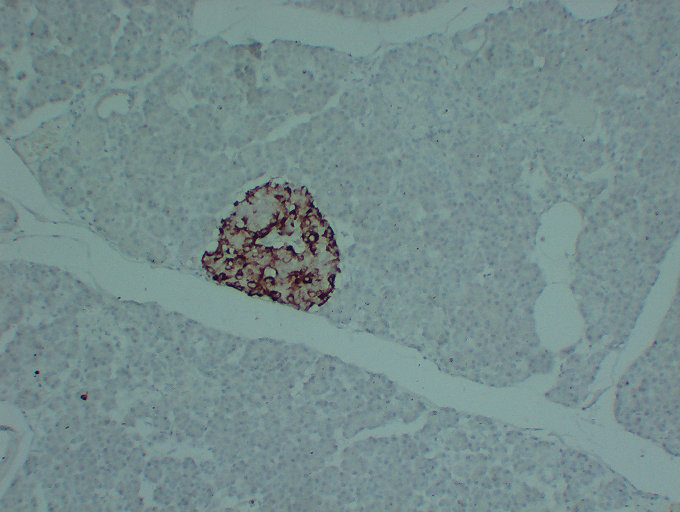 Tissue Inhibitor of Metalloproteinases 1(PT2236) mouse mAb